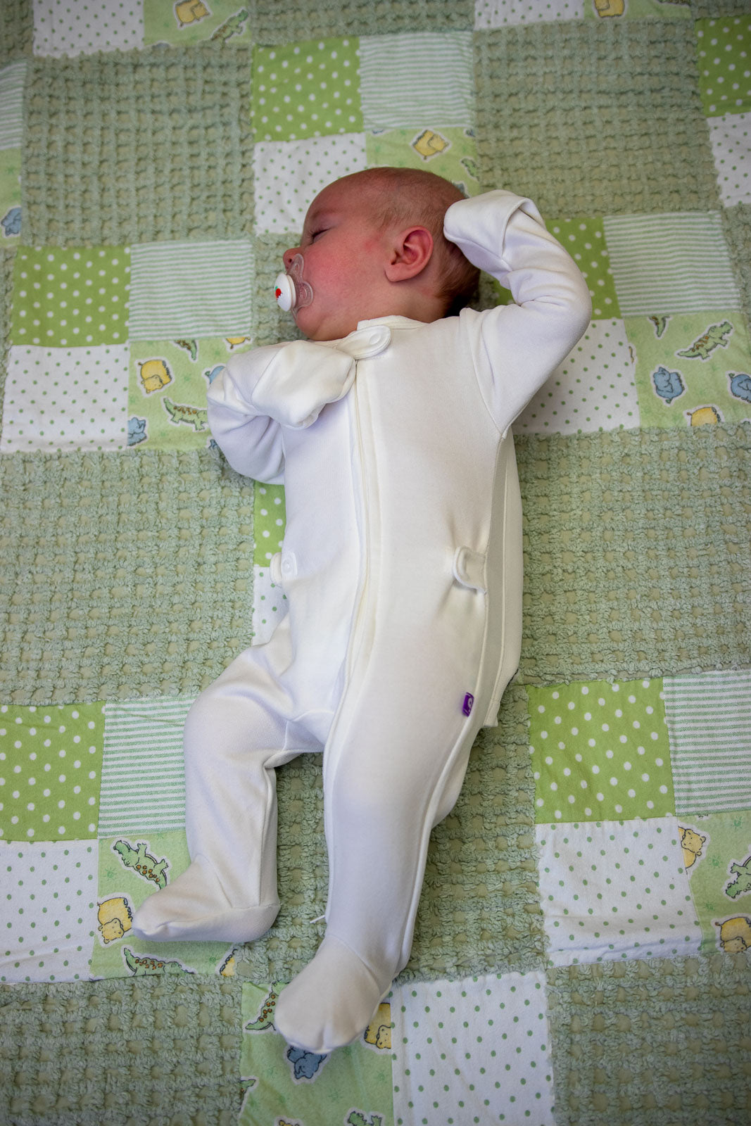 The MoWo: A Revolutionary Solution for Plagiocephaly (Flat Heads)