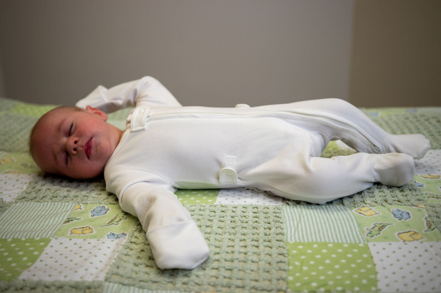 The MoWo: A Revolutionary Solution for Plagiocephaly (Flat Heads)