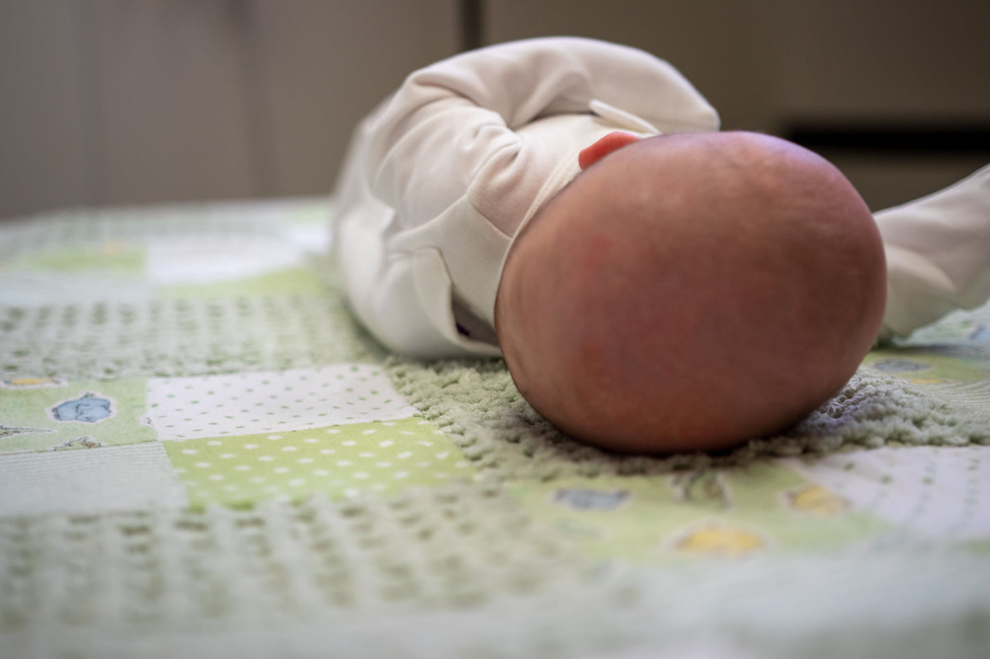 The MoWo: A Revolutionary Solution for Plagiocephaly (Flat Heads)